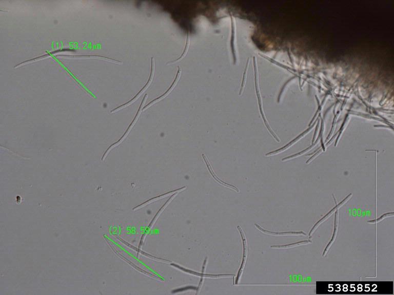 Asexual spores of the fungus Septoria tritici with a measurement scale and measurement of some individual spores