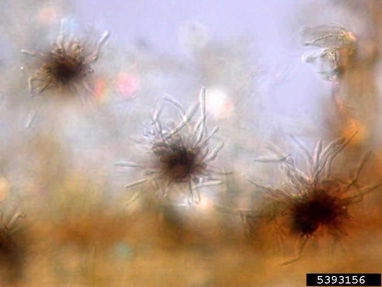 sporodochia, conidia; microscope, fresh tissue; Musa x 'Williams'