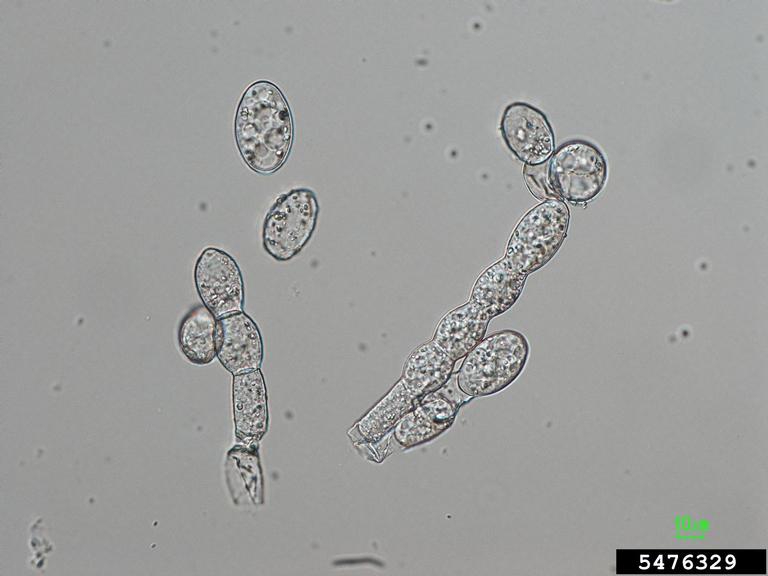 Asexual spore-producing stractures (conidiophores) and spores (conidia) of the Cucurbit Powdery mildew fungus, Podosphaera xanthii. The fungal structures were not exposed to 3% KOH solution.