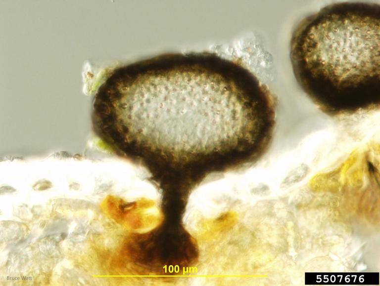 Rhizosphaera needle cast (Rhizosphaera pini)