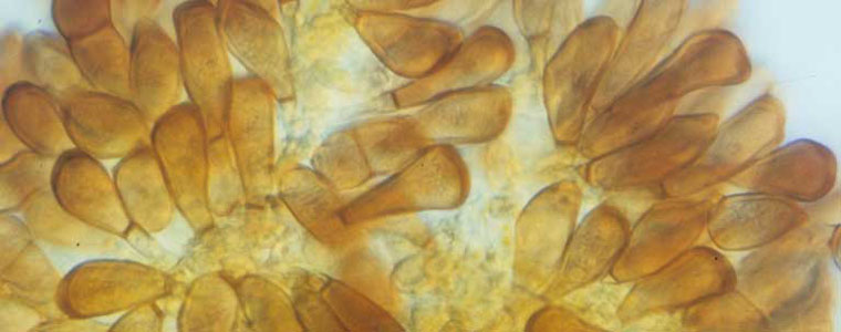 Image of a widely Prevalent fungi