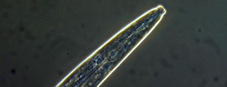 Image of a widely Prevalent nematodes